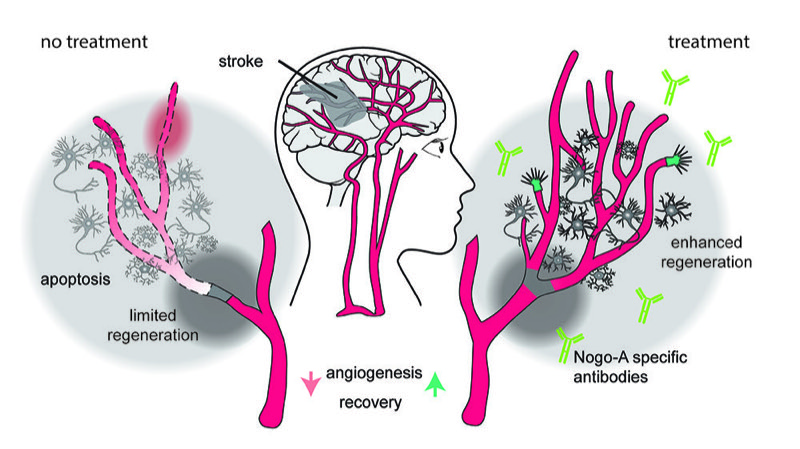 Medical Xpress preview: new therapy promotes vascular repair after stroke