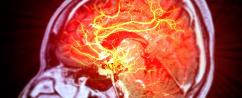 ScienceAlert preview: Stem Cells Repair Brain Damage Caused by Stroke in Mice