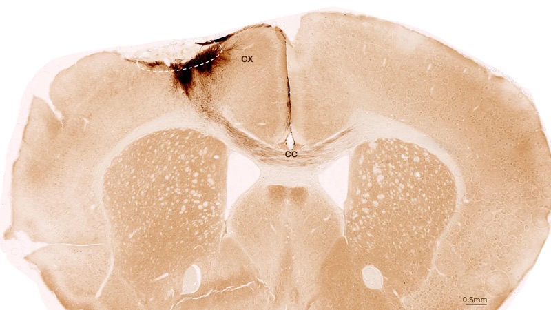 ScienceDaily preview: scientists reverse stroke damage with stem cells