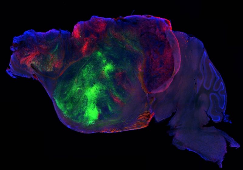 The Scientist preview: Human-Derived Brain Organoids Create Functional Networks in Mice