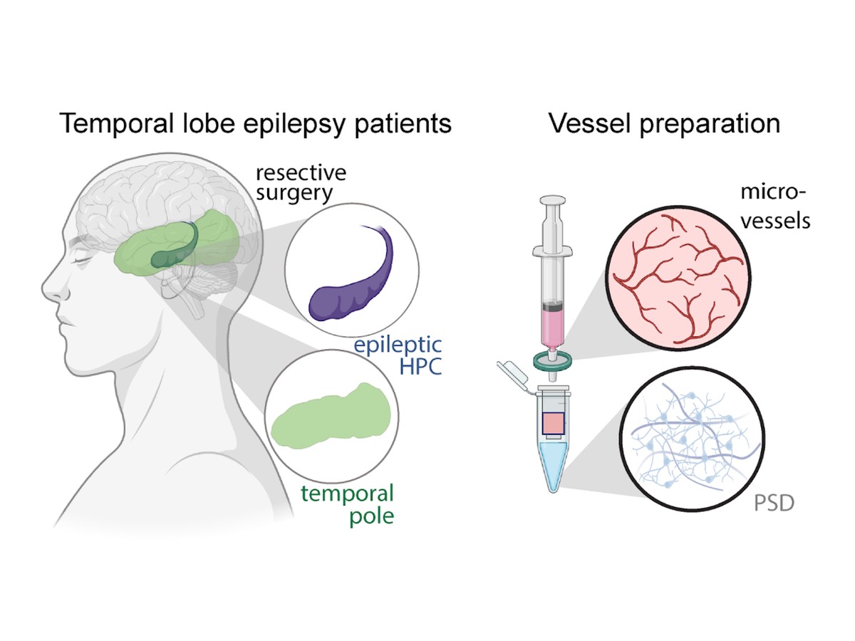 Workflow from epilepsy surgery tissue to microvessel and synaptic proteomes