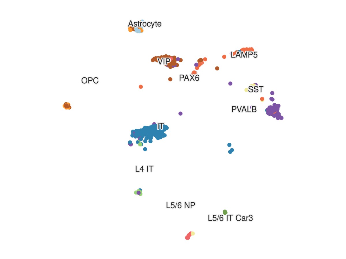 UMAP of human graft cell types